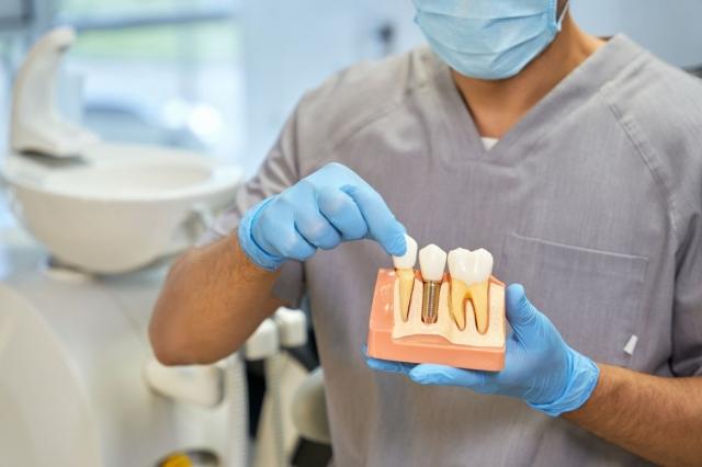 A Comprehensive Guide to Dental Implants by Dr. Loren Grossman
